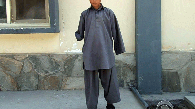 16-year-old Naragha lost both his hands last month when someone threw a grenade at a wedding he was attending.  