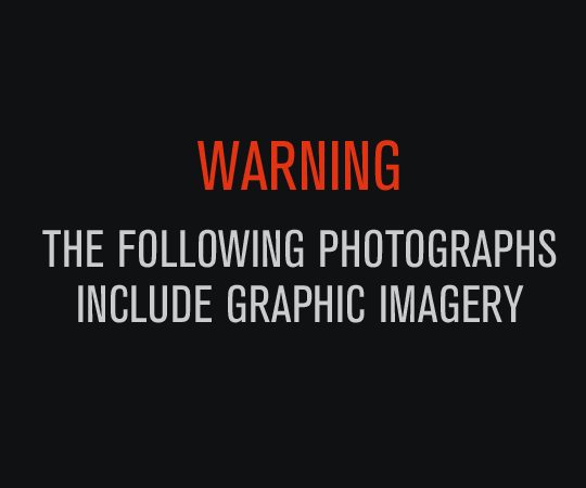 Graphic Image Warning 
