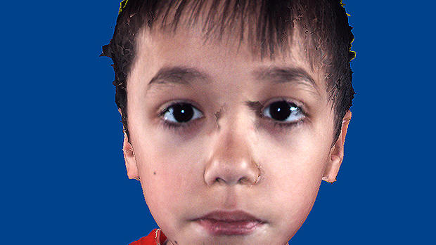 Is it autism? Facial features that show disorder 