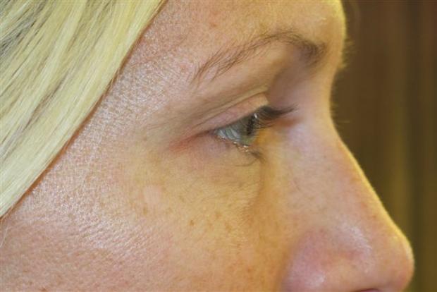 before-eyelash-tint-close-up.jpg 