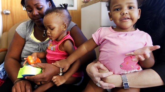 maria teresa, teresa maria, conjoined twins 