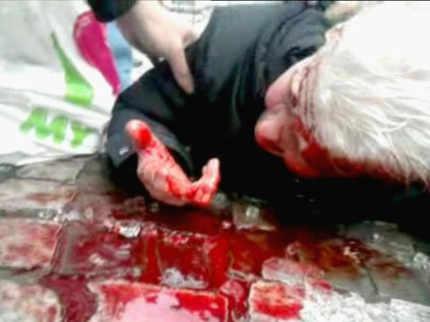 a man lays injured following a grenade attack  