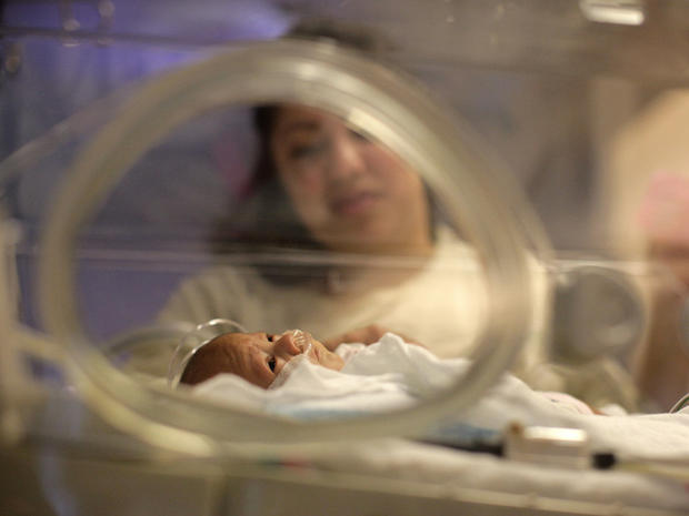 Haydee Ibarra, looks at her 14-week-old daughter, Melinda Star Guido, at the Los Angeles County-USC Medical Center in Los Angeles, Wednesday, Dec. 14, 2011. At birth, Melinda Star Guido tipped the scales at only 9 1/2 ounces, a tad less than the weight of 