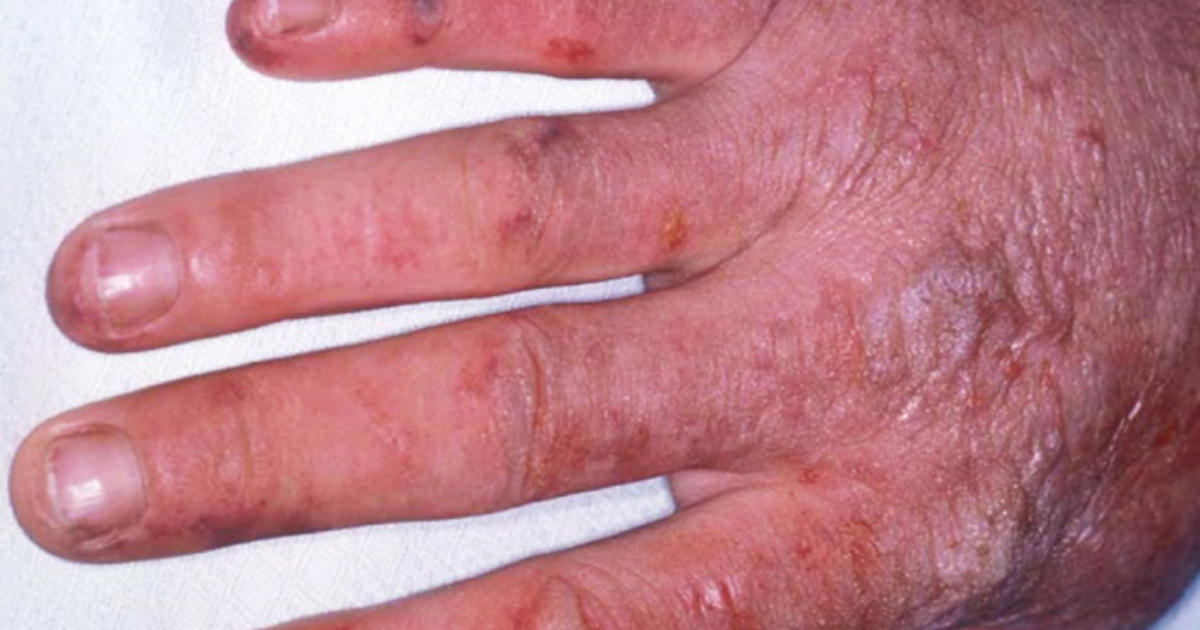 stamtavle Fange Berygtet 9 uncommon skin conditions