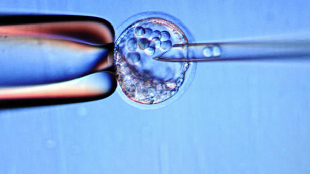 Close up of a screen showing an injection of embryonic stem cells in a muse embryo to set a genetically modified line Feb. 9, 2012, at the Centre d'Immunologie de Marseille-Luminy in Marseille, France. 