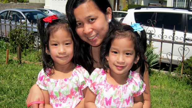 Formerly conjoined Sabuco twins: How are they now? 