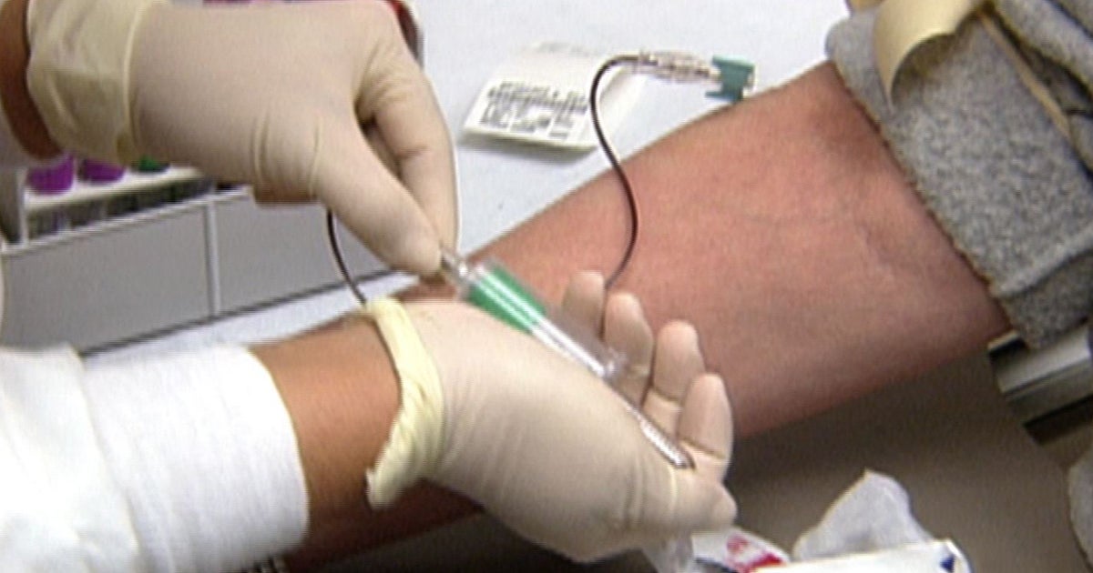 Statin treatment guidelines change: Who is affected? - CBS News