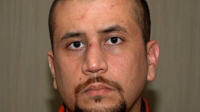New evidence: Zimmerman had bloodied nose 