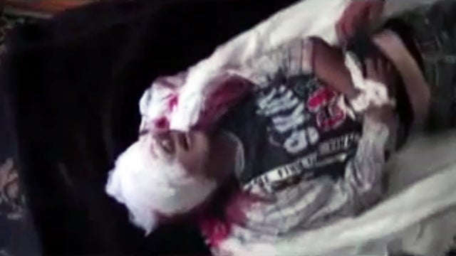 11-year-old boy shot by Syrian sniper 