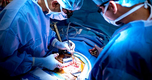 Inside look at kidney transplant (GRAPHIC IMAGES)