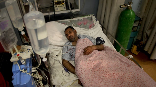In this photo taken on Dec. 19, 2010, A wounded Afghan soldier recuperates at Dawood National Military Hospital in Kabul, Afghanistan.  