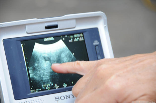 Ultrasound_-_pointing_out_fetus.jpg 