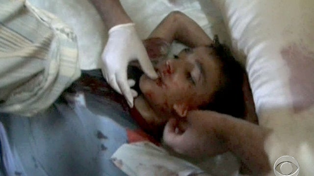 syria, wounded, boy, medical battalion, medics 