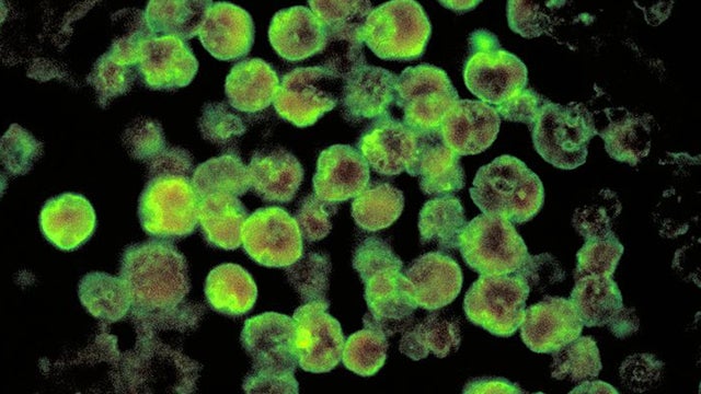 braineatingamoeba.jpg 