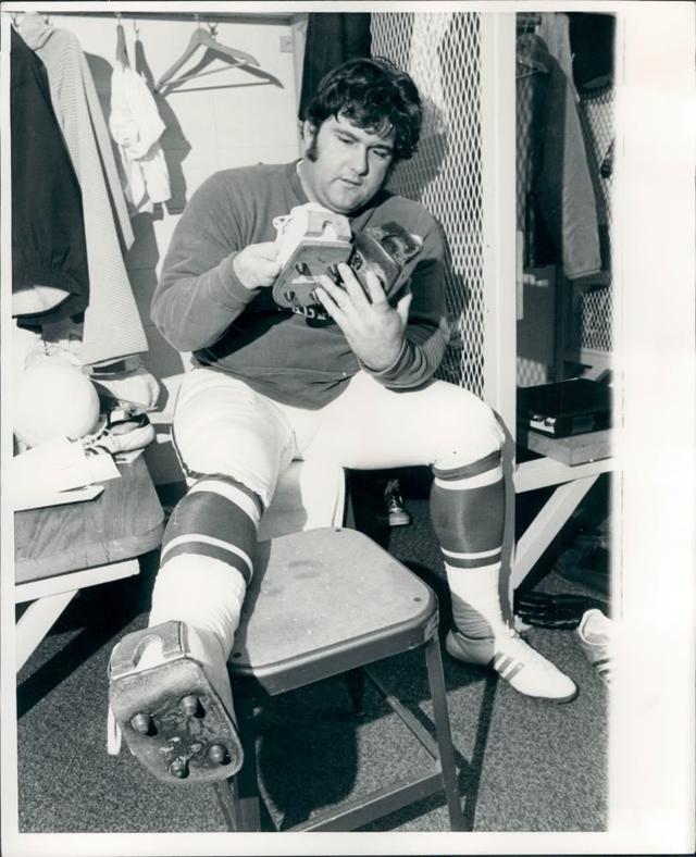 Photo: Former NFL Kicker Tom Dempsey's Club Foot - CBS Chicago