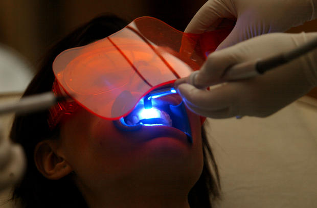 ultraviolet-uv-teeth-whitening 