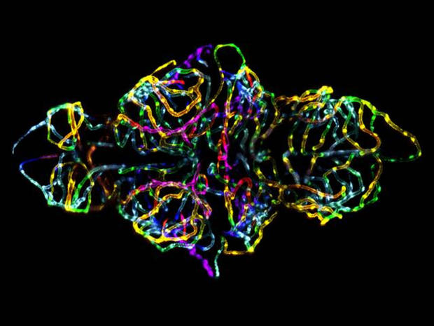 The blood-brain barrier in a live zebrafish embryo (20x) 