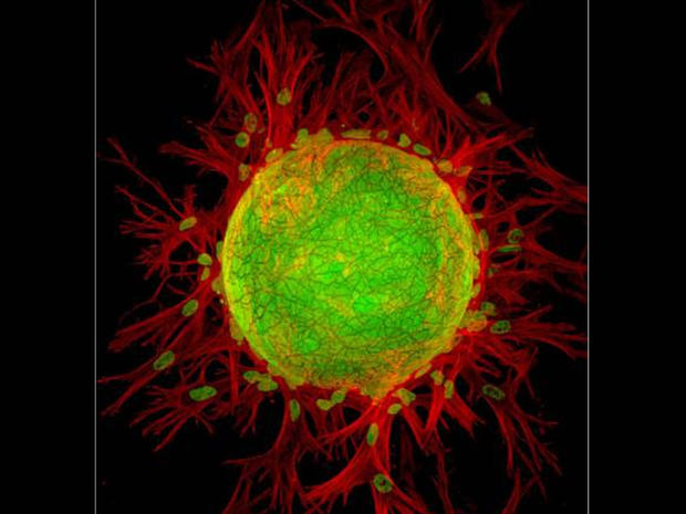 3D lymphangiogenesis assay. Cells sprout from dextran beads embedded in fibrin gel.(200x) 