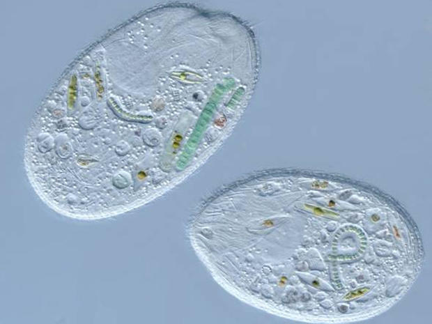 Sonderia sp. (a ciliate that preys upon various algae, diatoms, and cyanobacteria)(400x) 