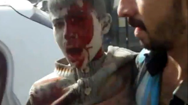 A wounded Syrian youth is placed in a car moments after an airstrike by Syrian warplanes in Ras al-Ayn, Syria, Nov. 12, 2012, in this image taken from video obtained from the Shaam News Network, which has been authenticated based on its contents and an As 