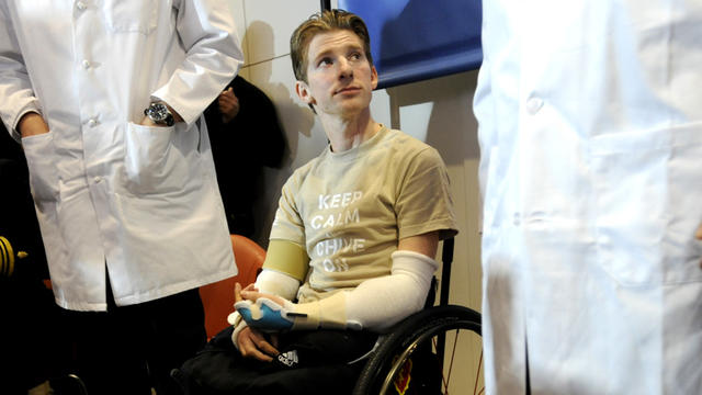 Retired Infantryman Brendan M. Marrocco listens during a news conference Tuesday, Jan. 29. 2013 at Johns Hopkins hospital in Baltimore. Marrocco received a transplant of two arms from a deceased donor after losing all four limbs in a 2009 roadside bomb at 