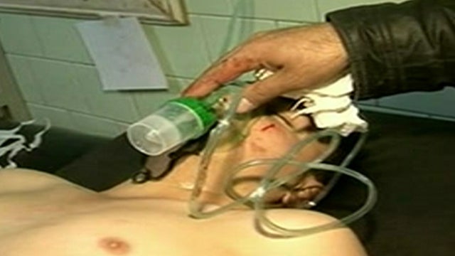 An image from Syrian state television shows a man being treated in an Aleppo province hospital after an alleged chemical weapons attack 