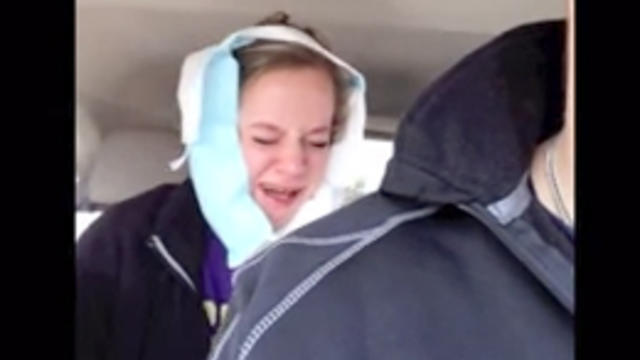 Abbie_Kritz_Wisdom_Teeth_Removal.jpg 