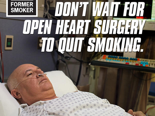 CDC unveils latest graphic anti-smoking ads in 2013 "Tips From Former Smokers" campaign 