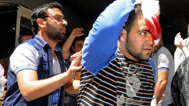 A Syrian man who was injured by a powerful explosion leaves a damaged building in the central district of Marjeh, in Damascus 