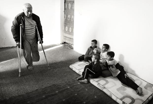 A Syrian farmer who lost his daughter and a leg in shelling 