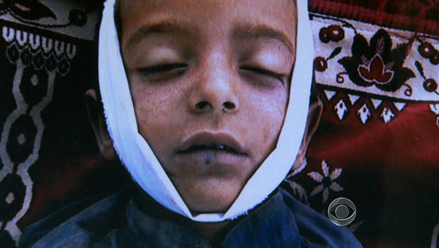 A picture of a Pakistani child Ackbar claims was killed in a drone strike. 