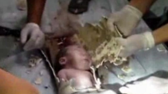 Newborn is seen just after firefighters and medics cut open sewer pipe in which boy was trapped May 25, 2013 in China. The pipe was directly beneath a squat toilet. Police are treating it as a case of attempted homicide. 