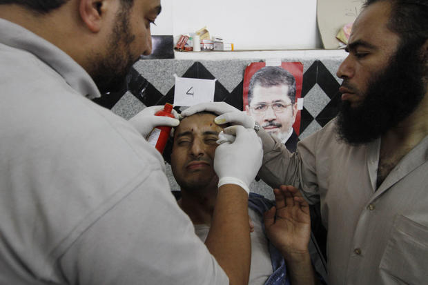 A wounded supporter of Egypt's ousted President Mohamed Morsi receives treatment at a local hospital in Cairo 