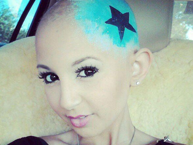 Girl who inspired cancer victims with makeup tips dies CBS News