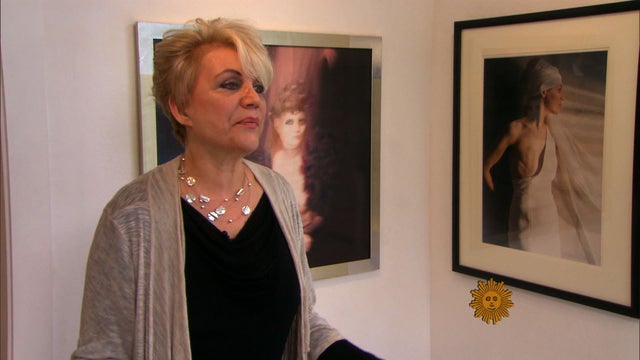 The model and the mastectomy: Baring all after breast cancer 