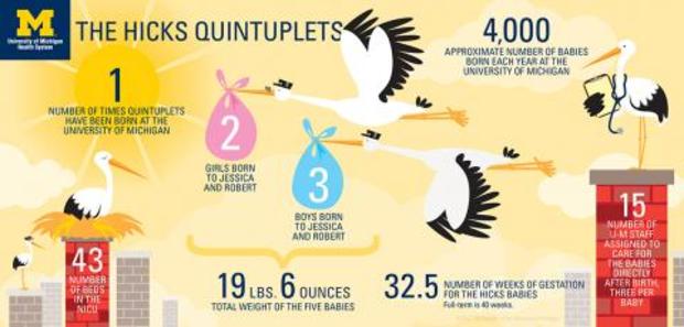 Hicks Quintuplets Infographic 