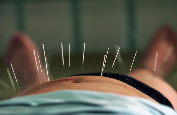 Clinic In Wuhan Treats Obese Teenagers With Acupuncture 