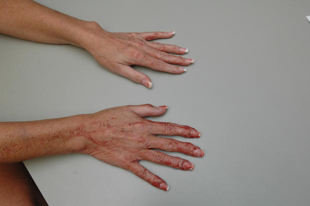 Kelley's bloodstained hands 