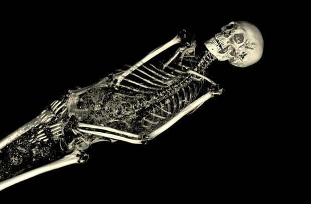 005linenman-body-bones.jpg 
