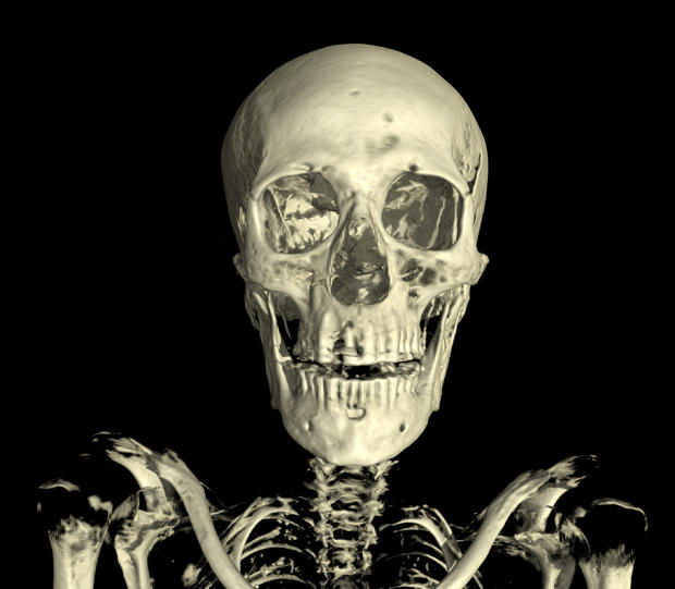017linenman-skull-front.jpg 