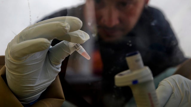 Guinea-Ebola-lab-blood-test 