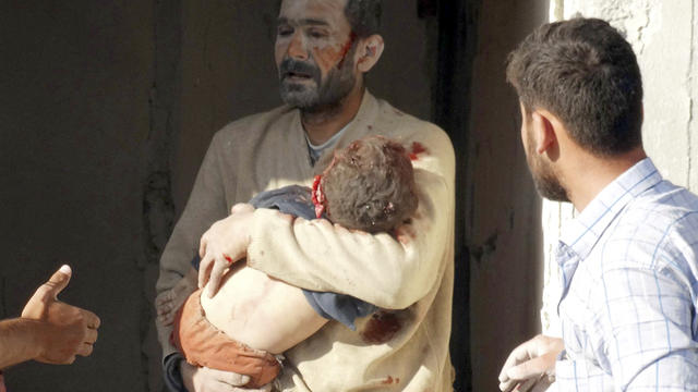 Children look at man carrying a wounded boy at a site hit by what activists said were barrel bombs dropped by forces loyal to Syria's President  in Aleppo province  