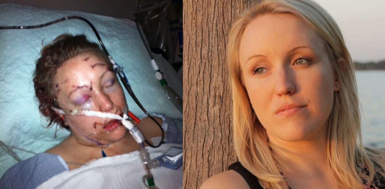 Melissa Dohme's brutal attack and incredible recovery