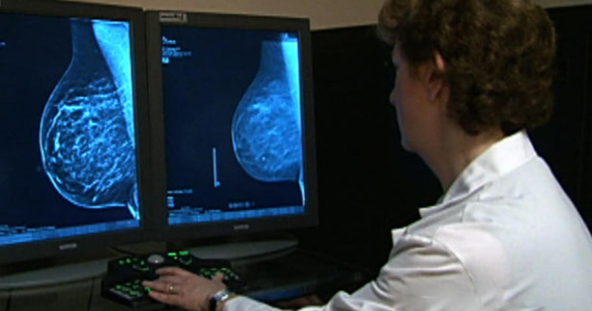 Do Women Over 75 Still Need Mammograms Cbs News