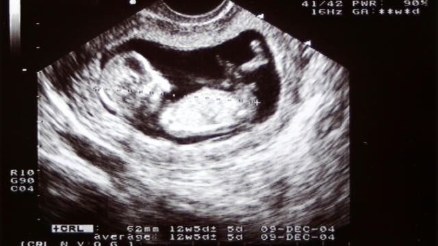 ultrasound.jpg 