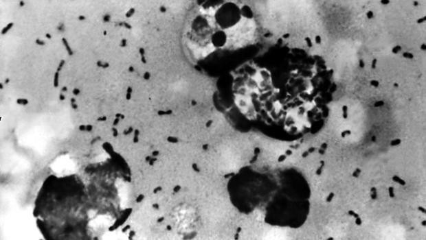 plague-bacteria-dis8620x350.jpg 