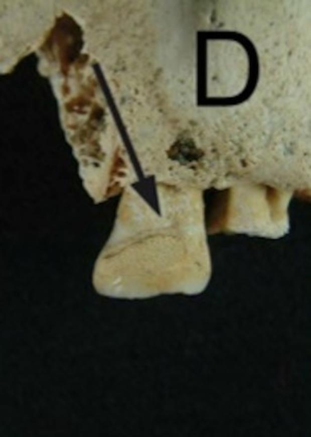 tooth-plaque.jpg 