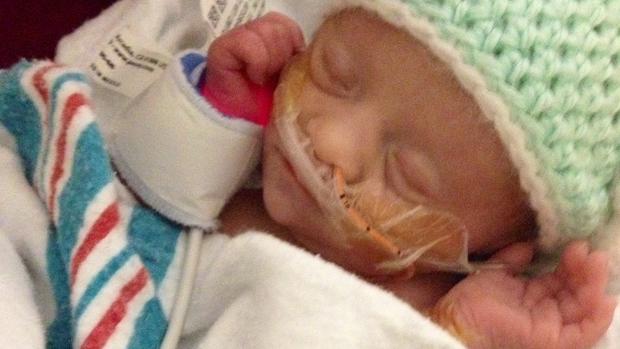 "Mighty Girl" preemie gets ground-breaking heart surgery 