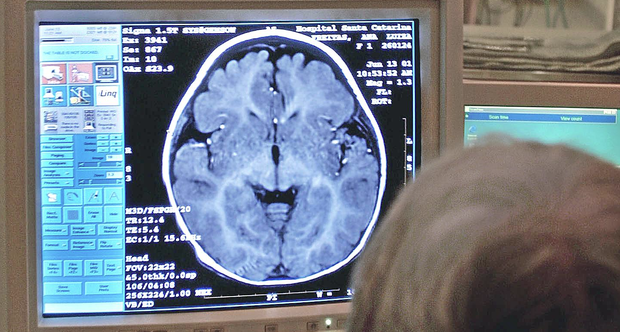 brain scan concussion generic test xray cat scan concussions 