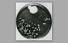 alexander-fleming-petri-dish-penicillin.jpg 